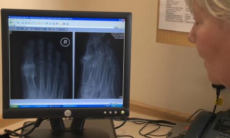 Photo of x-ray
