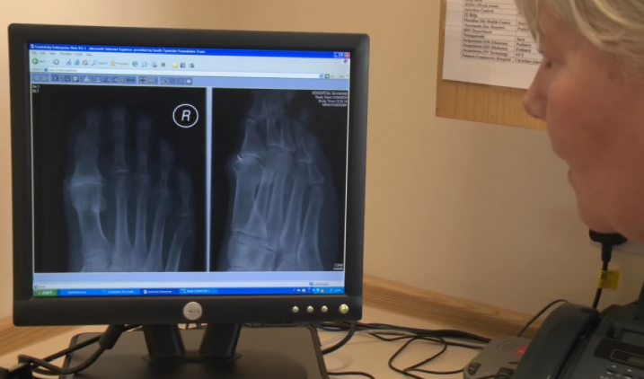 Photo of x-ray Photo of x-ray