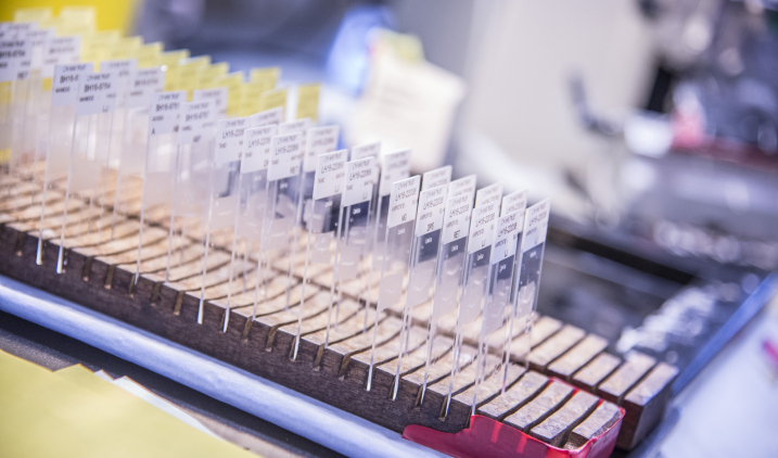 test heart blood Chemical Health Careers pathology test heart blood Chemical Health Careers pathology